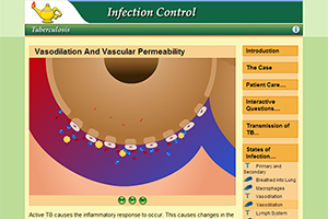 Tuberculosis and Infection Control Learning Module